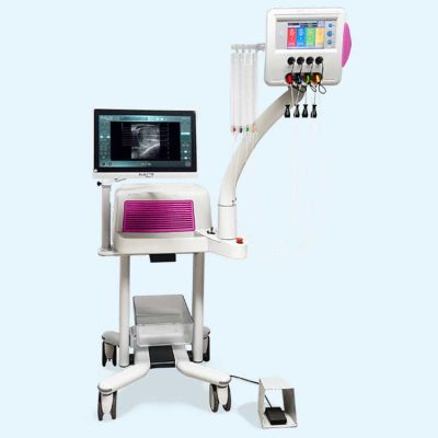 Echolaser – mini invazívny zákrok pri zväčšenej prostate